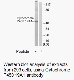 Cytochrome P450 19A1 Antibody - image 2