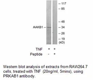 PRKAB1 Antibody - image 1