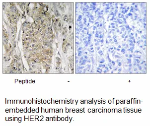 HER2 Antibody - image 2