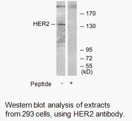 HER2 Antibody - image 3
