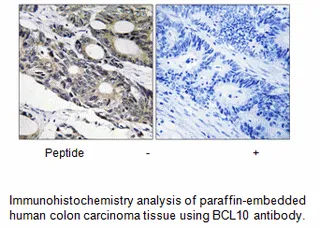 BCL10 Antibody - image 1