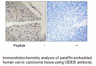 CIDEB Antibody - image 2