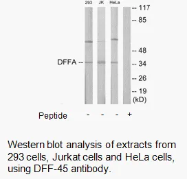 DFFA Antibody - image 2