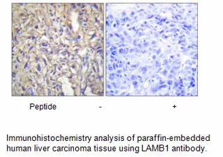 LAMB1 Antibody - image 2