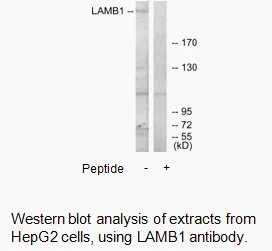 LAMB1 Antibody - image 3