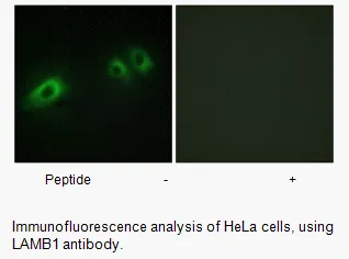 LAMB1 Antibody - image 1