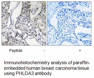 PHLDA3 Antibody - image 1
