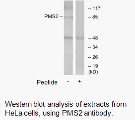 PMS2 Antibody - image 1