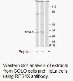 RPS4X Antibody - image 1