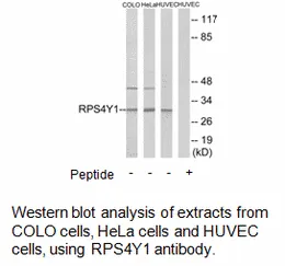 RPS4Y1 Antibody - image 2