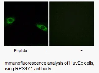 RPS4Y1 Antibody - image 1