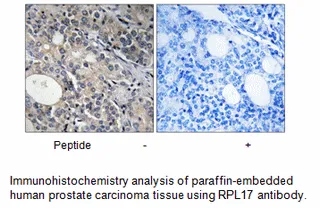 RPL17 Antibody - image 2