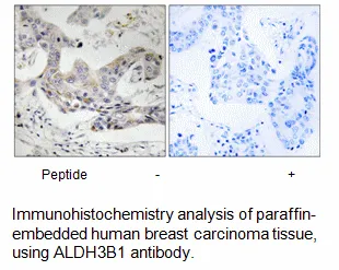 ALDH3B1 Antibody - image 1