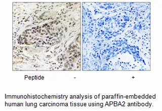 APBA2 Antibody - image 1