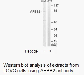 APBB2 Antibody - image 2