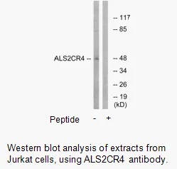 ALS2CR4 Antibody - image 1