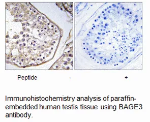 BAGE3 Antibody - image 1