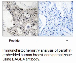BAGE4 Antibody - image 1