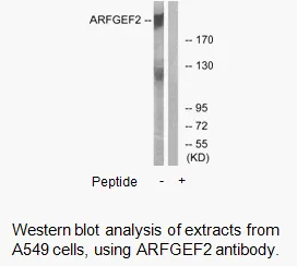 ARFGEF2 Antibody - image 2