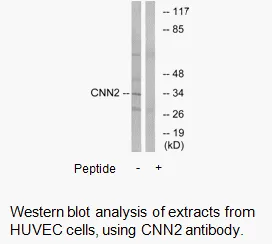 CNN2 Antibody - image 1