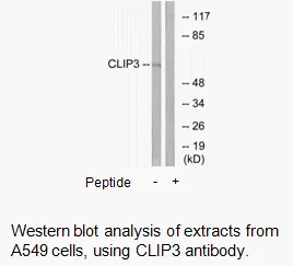 CLIP3 Antibody - image 2