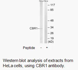 CBR1 Antibody - image 1