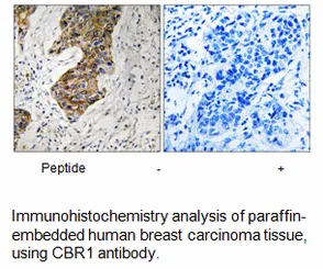 CBR1 Antibody - image 2
