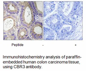 CBR3 Antibody - image 1
