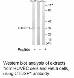 CTDSP1 Antibody - image 2