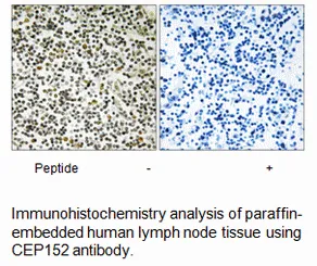 CEP152 Antibody - image 1