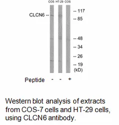 CLCN6 Antibody - image 1