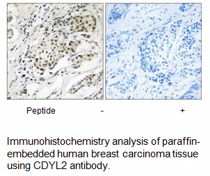 CDYL2 Antibody - image 1