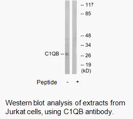 C1QB Antibody - image 2