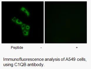 C1QB Antibody - image 1