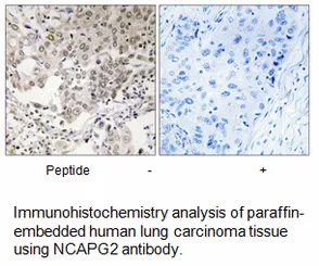 NCAPG2 Antibody - image 1