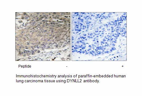 DYNLL2 Antibody - image 1