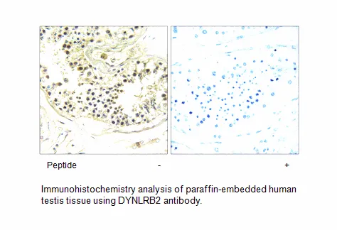 DYNLRB2 Antibody - image 1