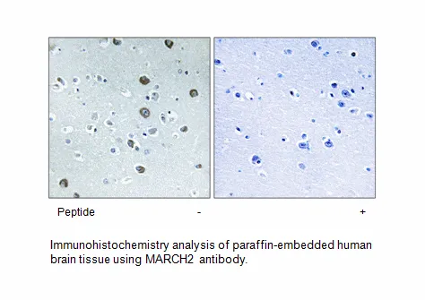 MARCH2 Antibody - image 2