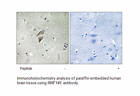 RNF149 Antibody - image 1