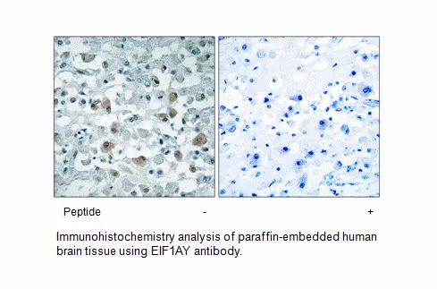 EIF1AY Antibody - image 1