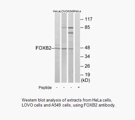FOXB2 Antibody - image 1