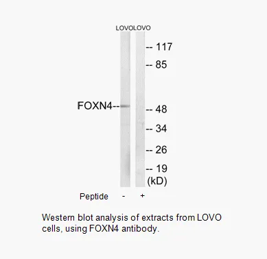 FOXN4 Antibody - image 1