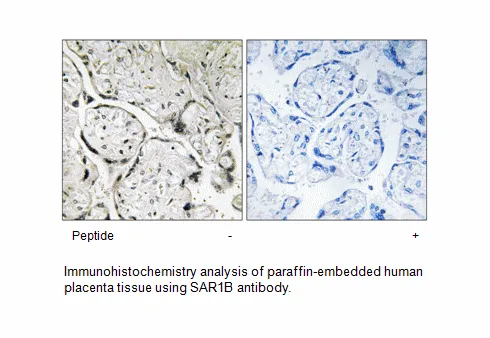 SAR1B Antibody - image 1