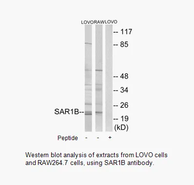 SAR1B Antibody - image 2