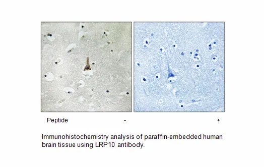 LRP10 Antibody - image 1