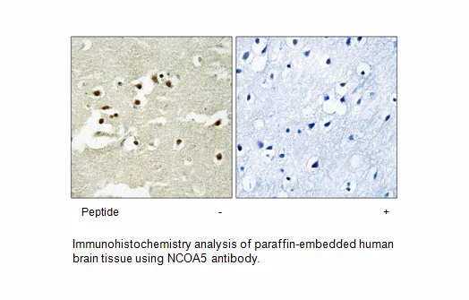 NCOA5 Antibody - image 1