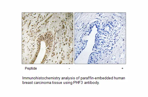 PHF3 Antibody - image 1
