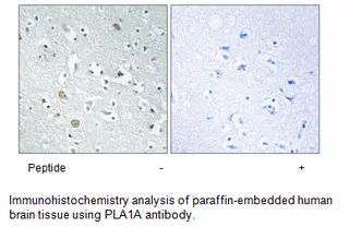 PLA1A Antibody - image 1