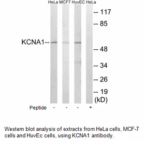 KCNA1 Antibody - image 1