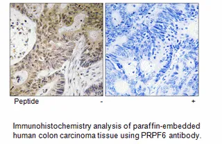 PRPF6 Antibody - image 1